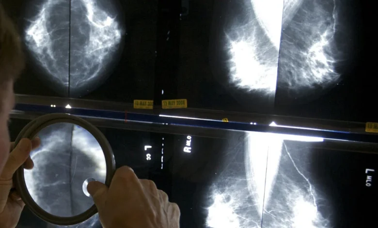AI firms believe mammograms can spot multiple health risks
