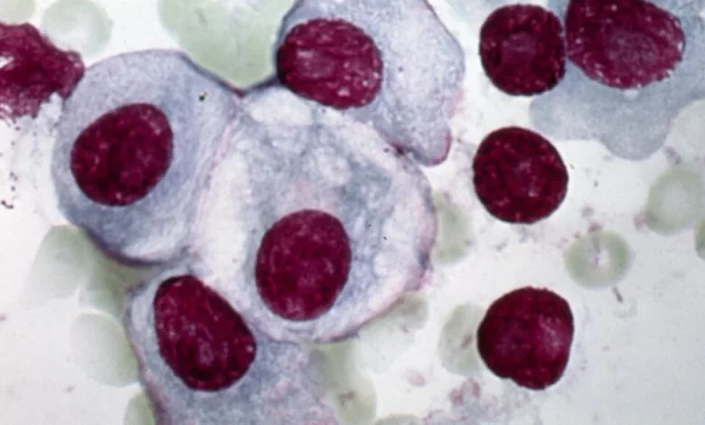 Gilead, Arcellx multiple myeloma drug anito-cel reports strong data