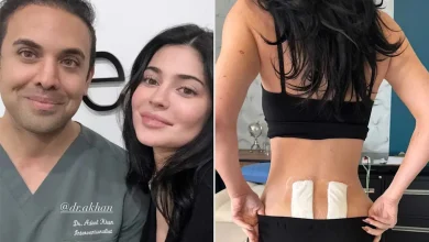 Kylie Jenner Reveals She Underwent Stem Cell Therapy to Get 'Relief' from Chronic Back Pain Following Pregnancy