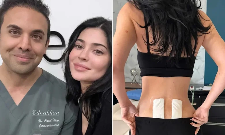 Kylie Jenner Reveals She Underwent Stem Cell Therapy to Get 'Relief' from Chronic Back Pain Following Pregnancy