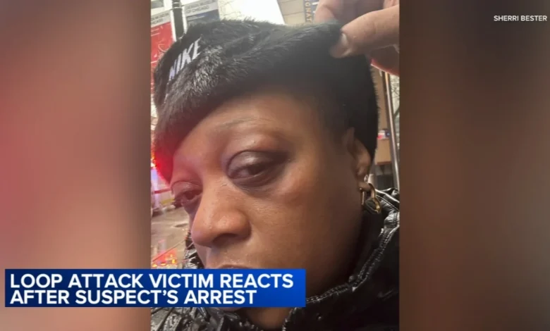 Loop puncher Chicago news: Marlon Miller ordered detained after alleged attacks, some while wearing ankle monitor, officials say