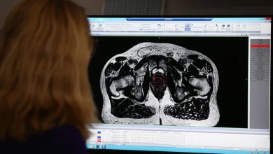 Trial for prostate cancer treatment with fewer side-effects launches in UK