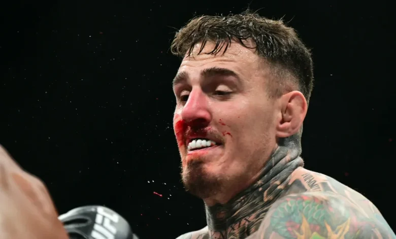 UFC champ Tom Aspinall moving forward with double eye surgery