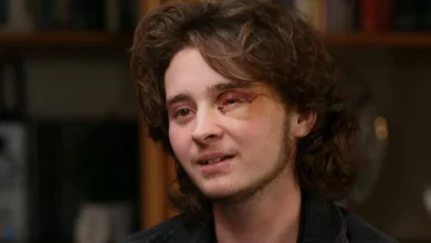 21-year-old says he's blind in left eye after federal agent shot him with less-lethal round at California protest
