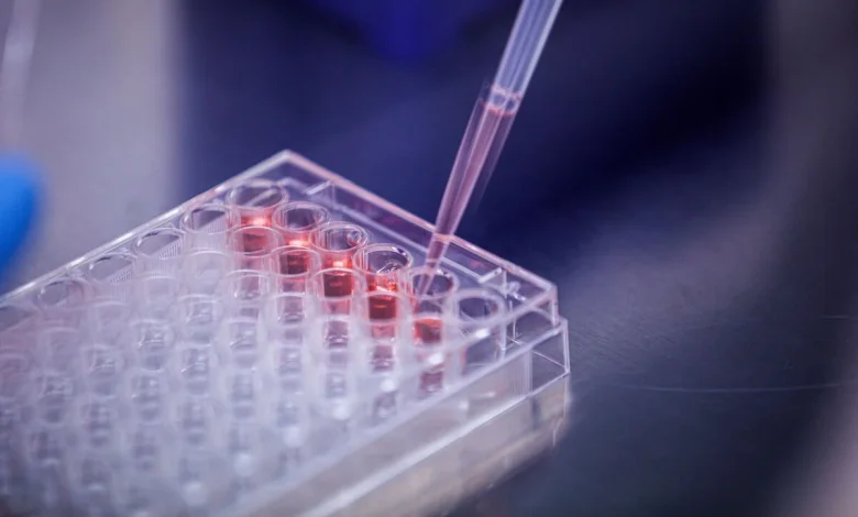 Abivax Pares Gains as Speculation Over a Takeover Whipsaws