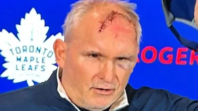 Berube shows off forehead stitches from gym accident