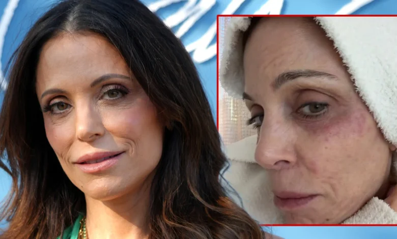 Bethenny Frankel Contracts Bacterial Infection After Partying in St. Barths