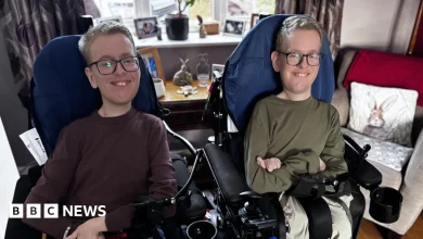 'Jesy Nelson's twins will help each other through SMA like we do'