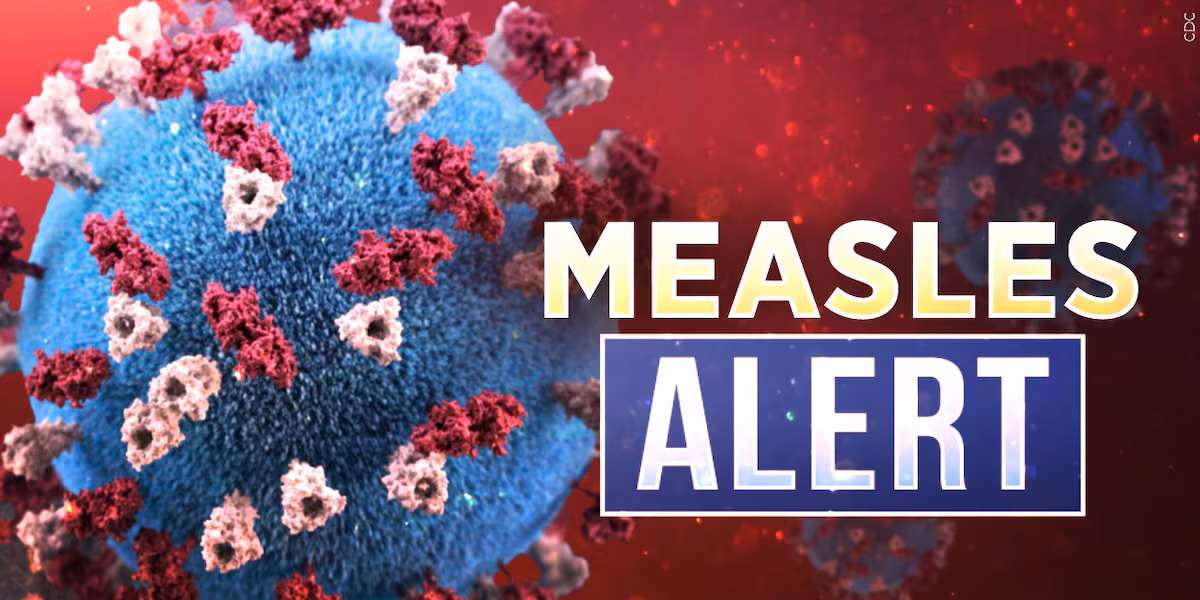 Kentucky reports first positive measles case on 2026