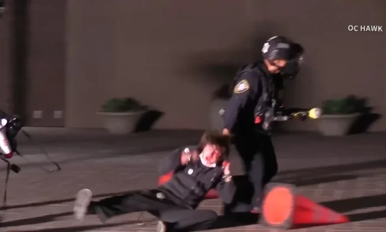 Protester blind in left eye after federal agent fired projectile during Santa Ana protest, family says