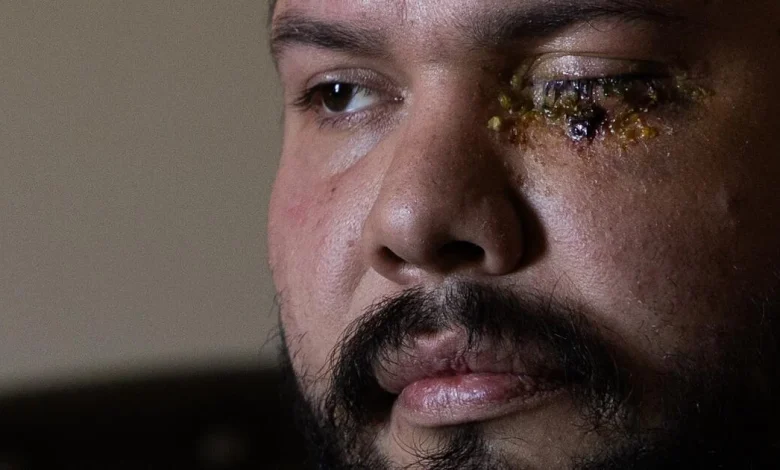 Second man says Homeland Security blinded him at anti-ICE rally