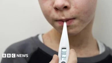 UK loses measles elimination status