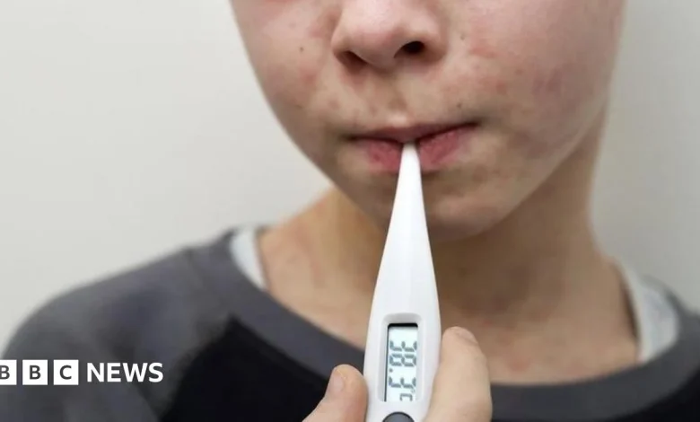 UK loses measles elimination status