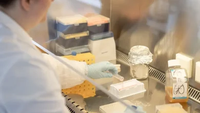 View / Institutions are missing AI’s real potential for drug discovery