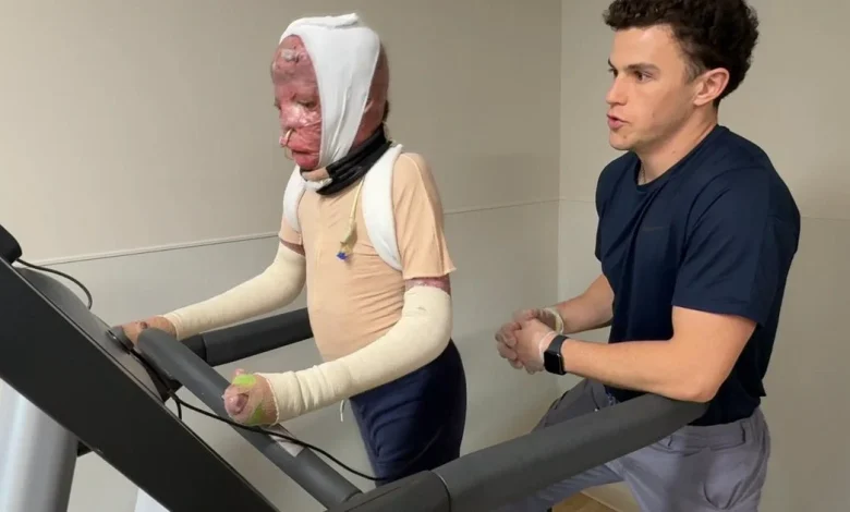 1 year after deadly Northeast Philadelphia plane crash, inside 10-year-old Ramesses' road to recovery