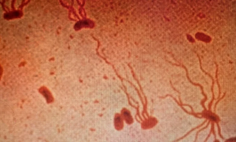 Ancient Killer Is Rapidly Gaining Resistance to Antibiotics, Scientists Warn