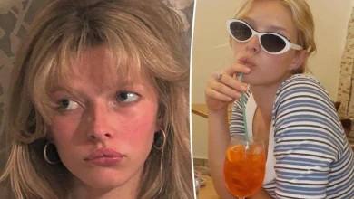 Apple Martin enlisted mom Gwyneth Paltrow to help with her 'really bad' acne struggles