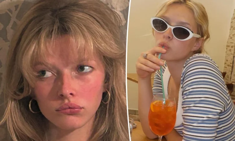 Apple Martin enlisted mom Gwyneth Paltrow to help with her 'really bad' acne struggles