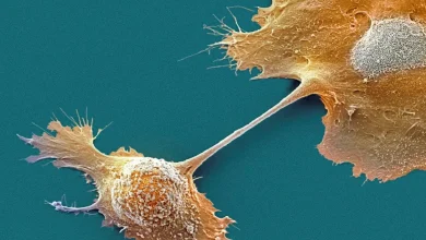 FDA Approves Pancreatic Cancer Device That Extends Survival From Israeli-founded Novocure