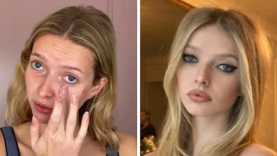 Gwyneth Paltrow's 'Nepo Baby' Apple Martin Reveals All The Cosmetic Procedures She's Had