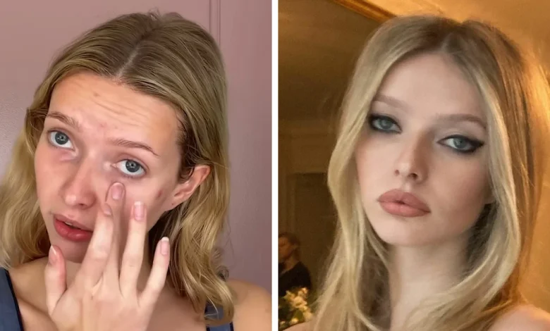 Gwyneth Paltrow's 'Nepo Baby' Apple Martin Reveals All The Cosmetic Procedures She's Had