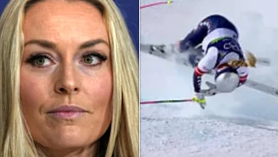 Lindsey Vonn Shows Off Her X-Ray ... And Yikes