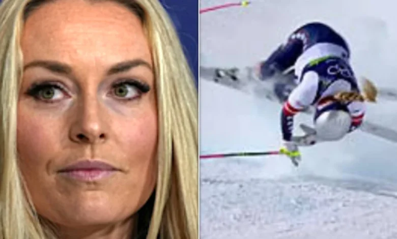 Lindsey Vonn Shows Off Her X-Ray ... And Yikes