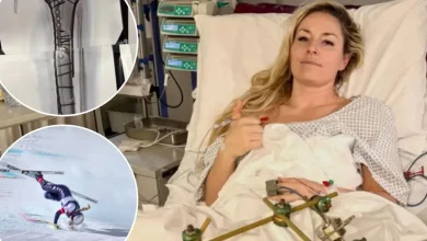 Lindsey Vonn offers gruesome update after Olympic crash: 'Bionic for real now'