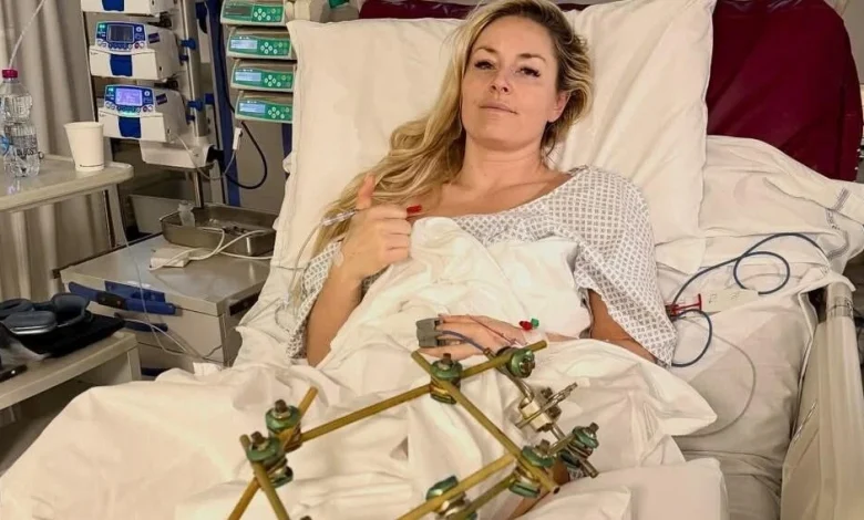 Lindsey Vonn says she had third surgery, is making "slow" progress after crash at 2026 Winter Olympics