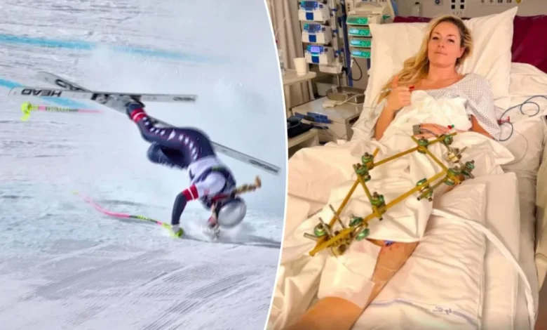 Lindsey Vonn set for 'further surgeries' after flying back to US