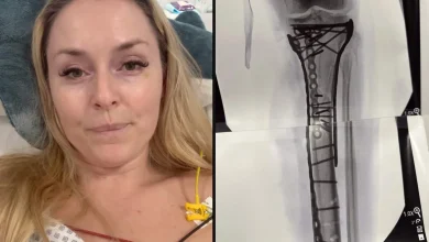Lindsey Vonn’s ‘car crash’ injury explained: How long could her recovery take and will she ski again?