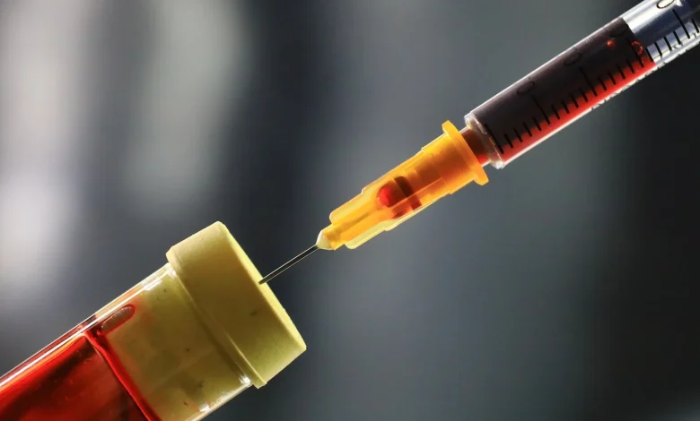 New approach roughly predicts when Alzheimer’s symptoms begin