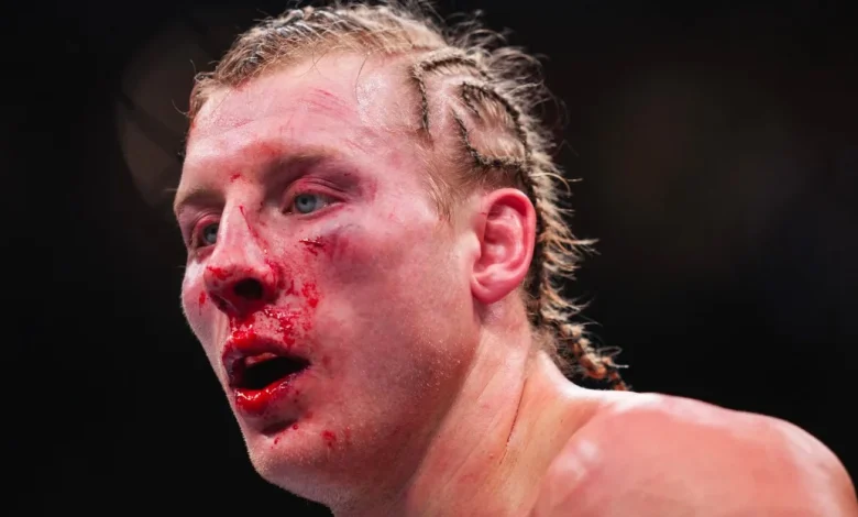 Paddy Pimblett reflects on brutal Justin Gaethje loss: ‘He made my face look different’