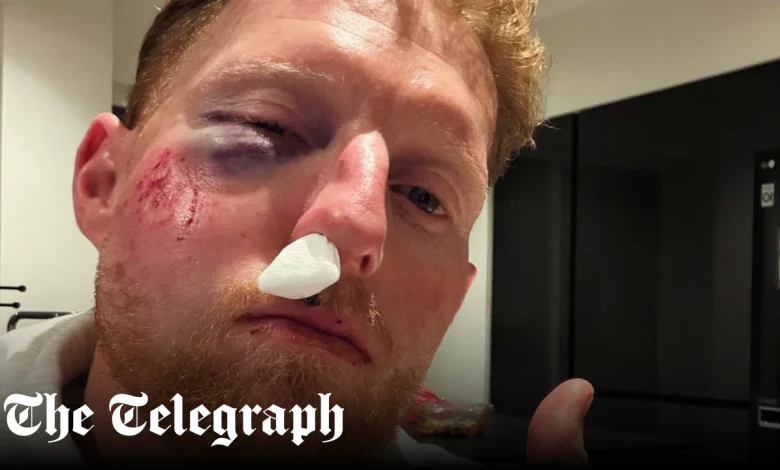 Pictured: Ben Stokes suffers facial injuries after being ‘hit by ball’