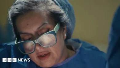 TV producers spotted my Insta breast surgery pictures