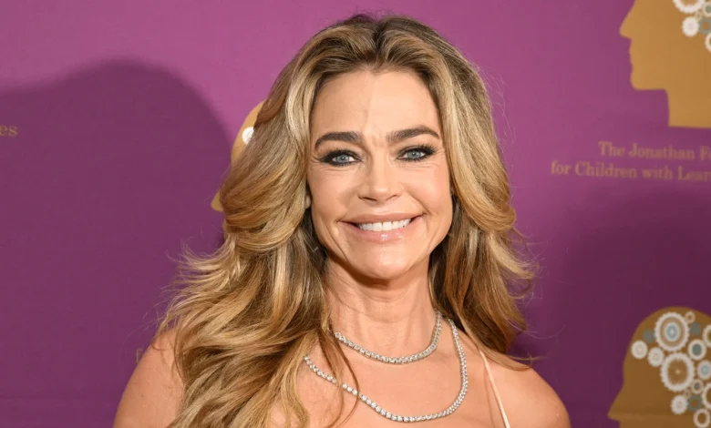 Before & After Pics Of Denise Richards' Facelift Are Absolutely Wild
