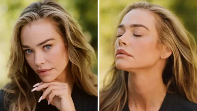 Denise Richards Opens Up About Her Facelift