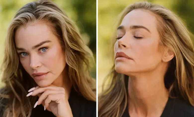 Denise Richards Opens Up About Her Facelift