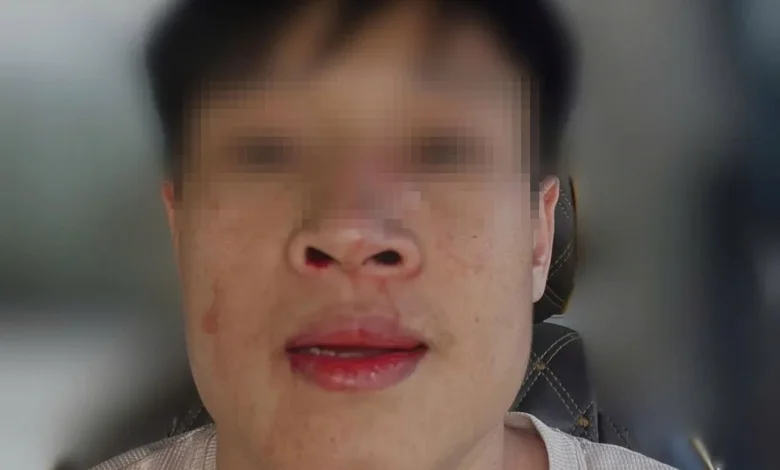 Điều tra vụ người đàn ông bị hành hung tại TDP Giữa Lương Quy