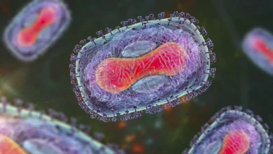 First known case of severe Mpox strain discovered in New York City