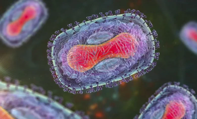 First known case of severe Mpox strain discovered in New York City