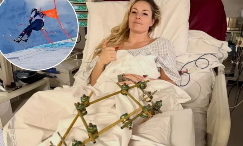 Lindsey Vonn spurns retirement talk after dad's plea following injury