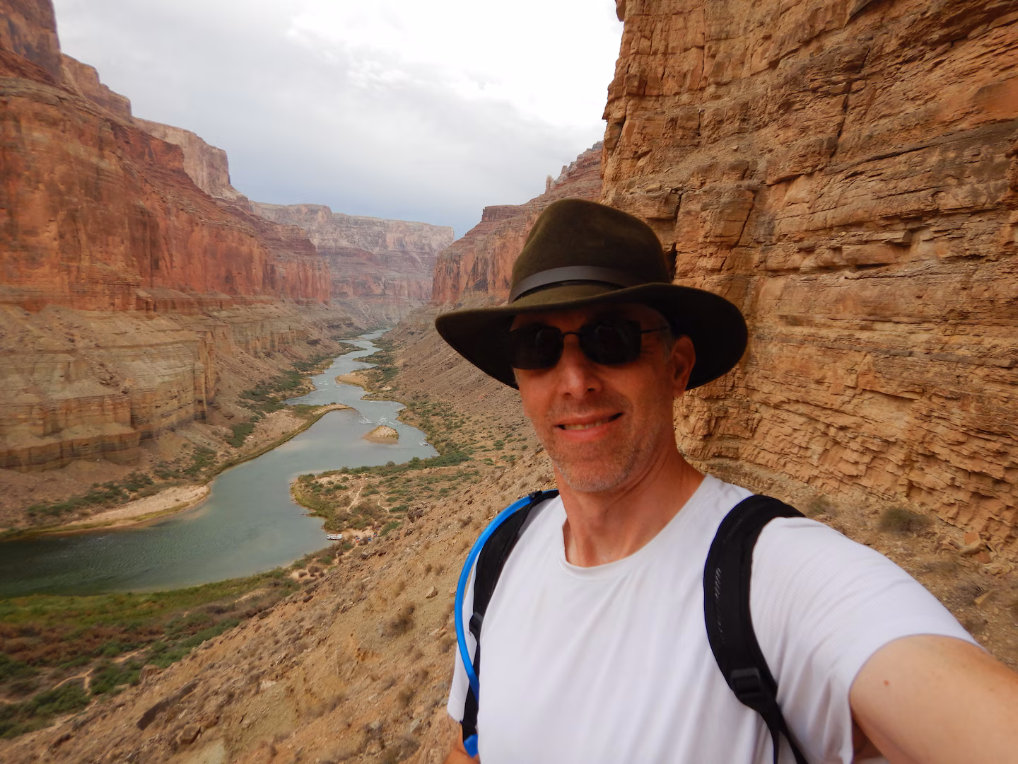 Medical Mysteries: Rare syndrome diagnosed after arthritis misdiagnosis