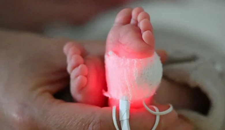 Millions of preterm births and thousands of infant deaths linked to plastic chemical