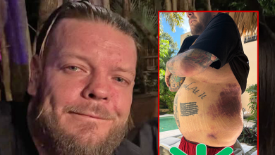 'Pawn Stars' Corey Harrison Asks Fans to Help Pay Medical Bills After Health Ordeal
