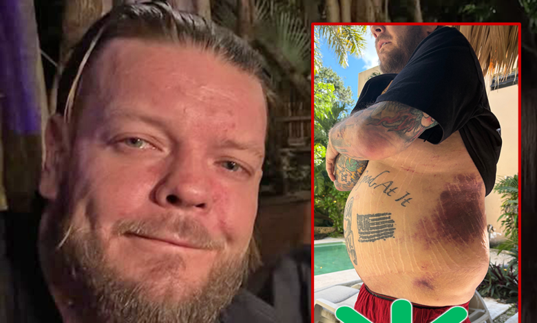 'Pawn Stars' Corey Harrison Asks Fans to Help Pay Medical Bills After Health Ordeal