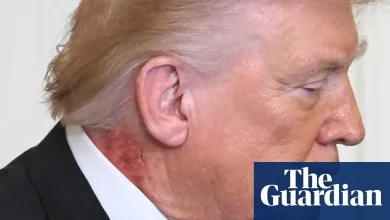 Trump neck rash from ‘preventative’ skin treatment, White House says