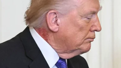 Trump’s neck rash is because of ‘preventative skin treatment,’ his doctor says