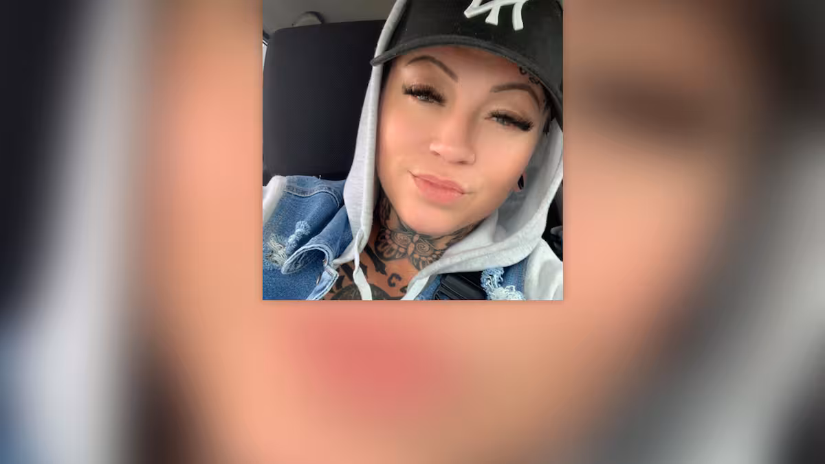 Une Québécoise perd la vie à la suite de chirurgies plastiques en Turquie