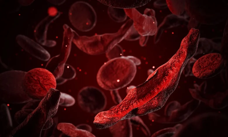 $3 million prize goes to duo whose research led to first sickle cell CRISPR therapy